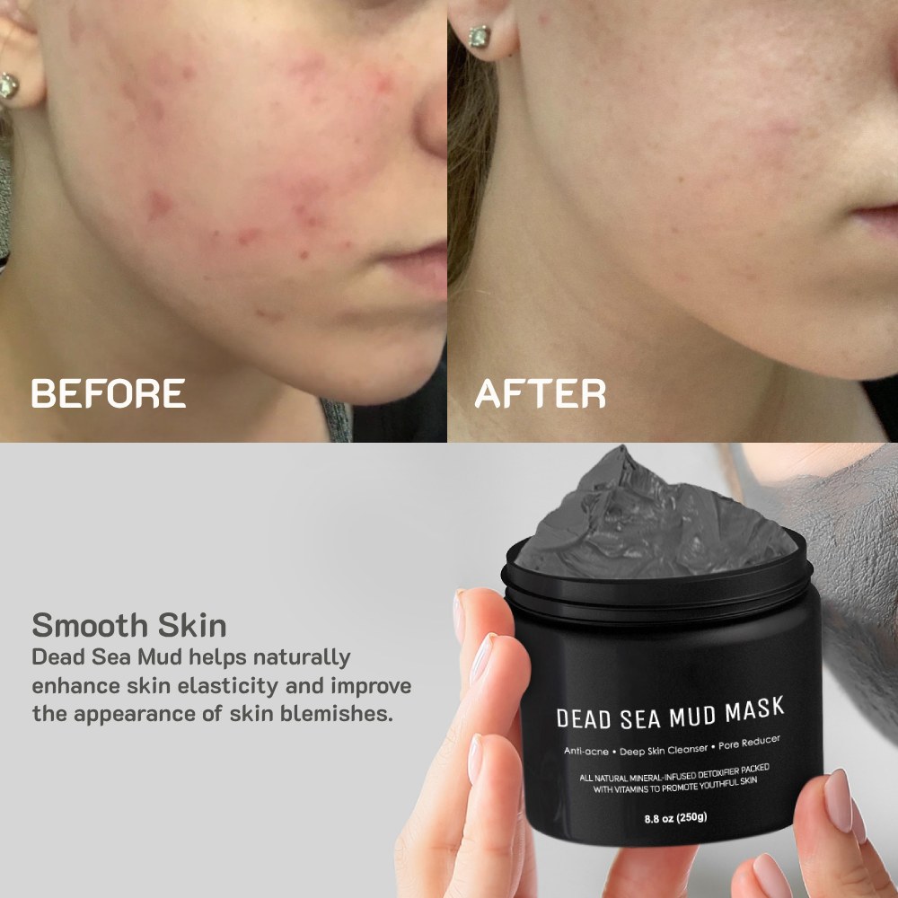 Dead Sea Mud Mask: image 8