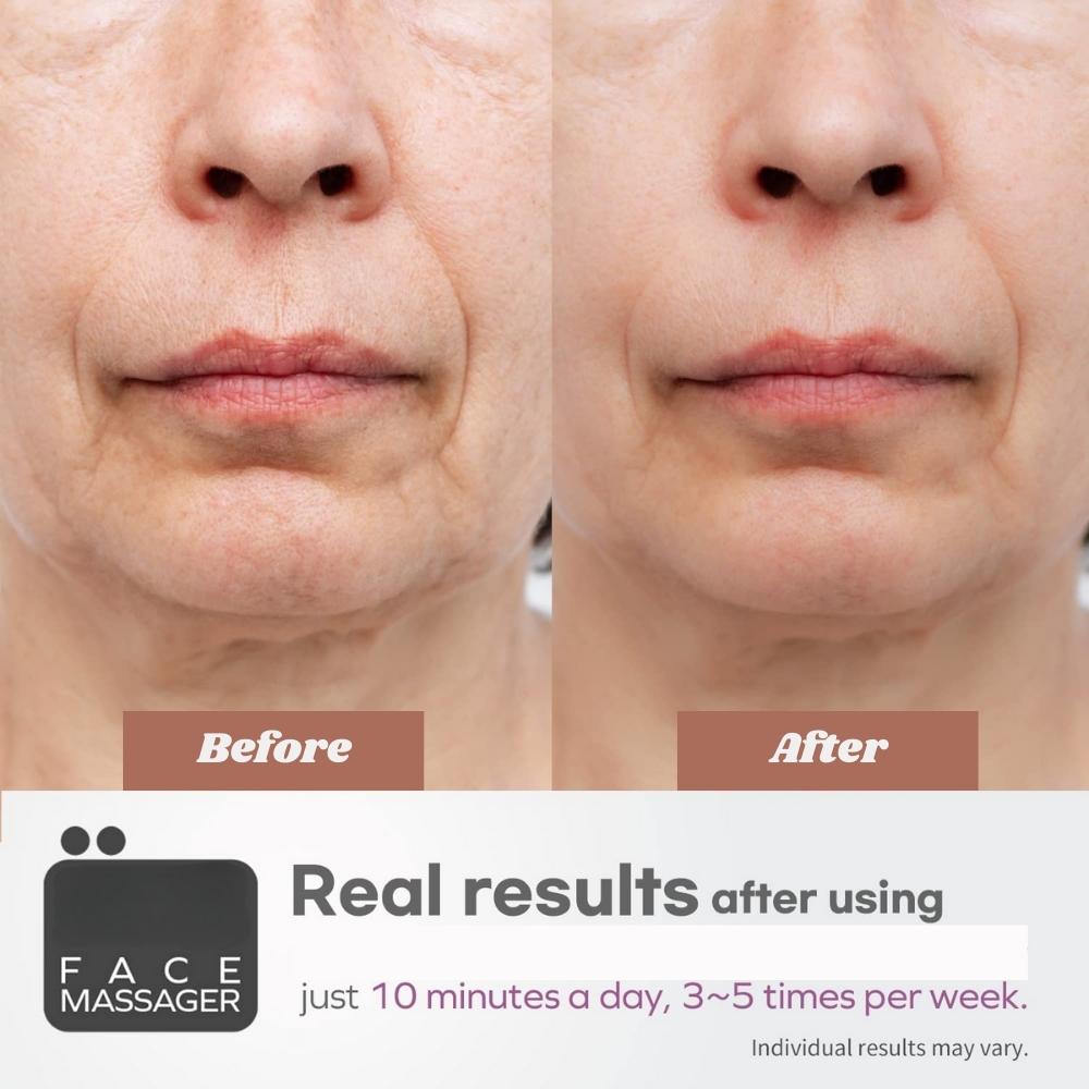 Facial Massager Device: image 5